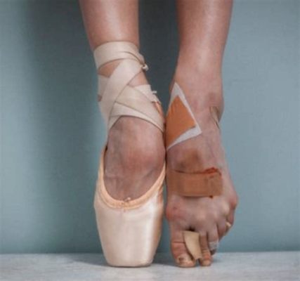 do ballet dancers have bad feet and do their rigorous training routines impact their long-term health?